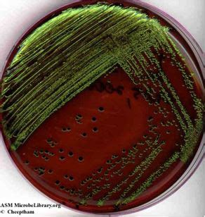 enterobacter aerogenes on emb|8.1: Introduction to Bacterial Identification using Culture .